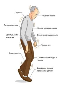 день борьбы с болезнью Паркинсона